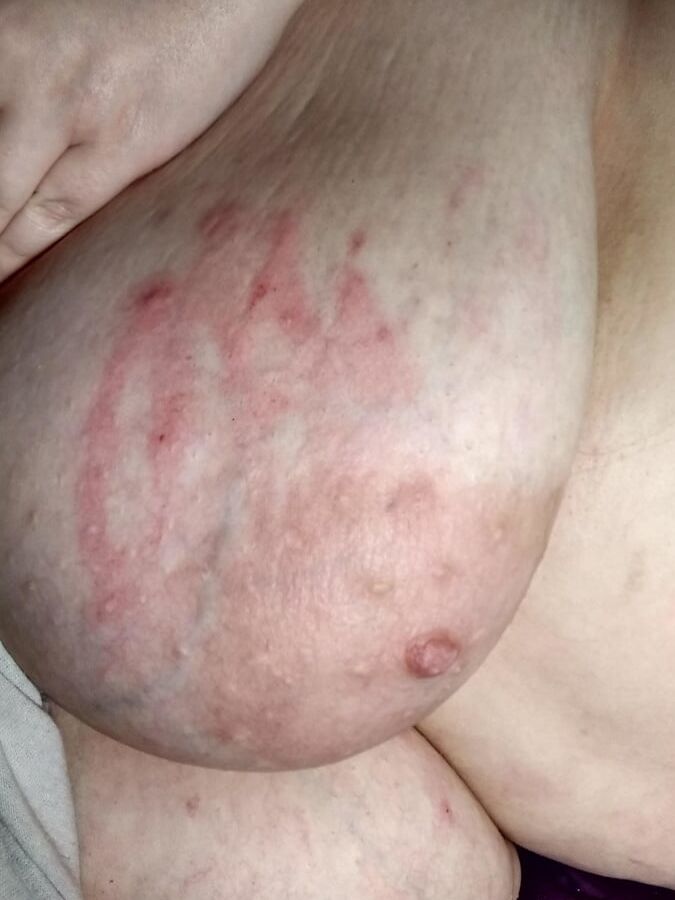 BBW Clinic Worker with huge Tits