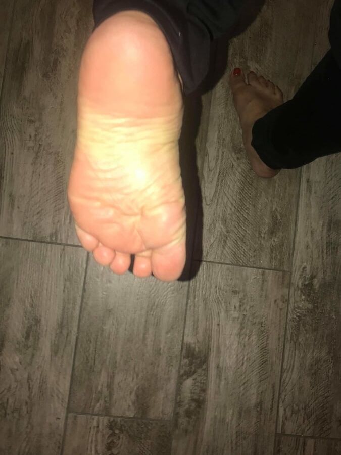 year old BBW mexican Soles Nut draining wrinkles
