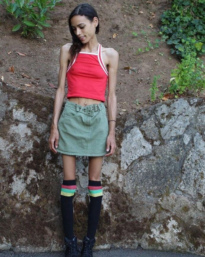 Skinny gallery