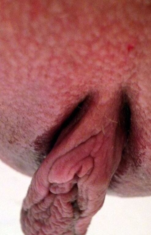 Amateur Photoassarty - Female Pussy