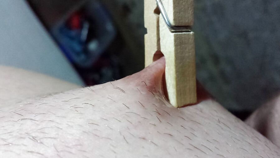 Nipple Pain