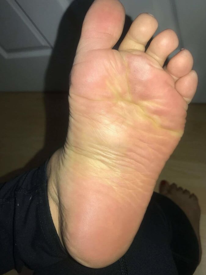 year old BBW mexican Soles Nut draining wrinkles