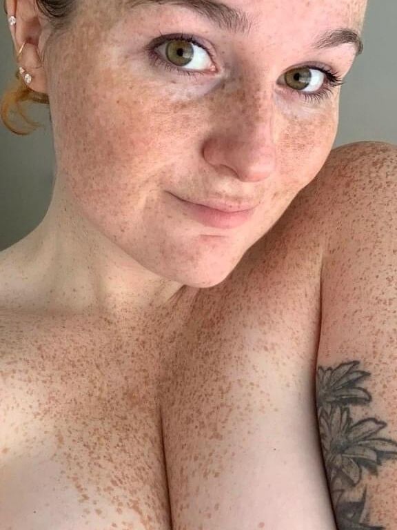 Redhair and freckles