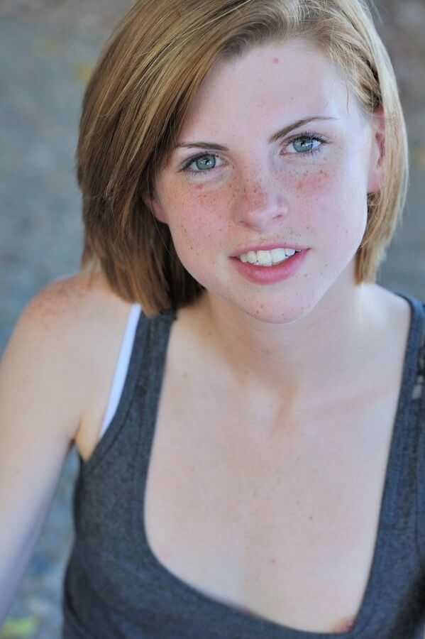 Freckles