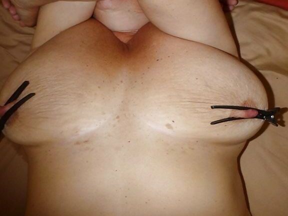Nipple erection
