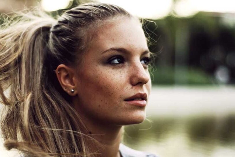 Freckles
