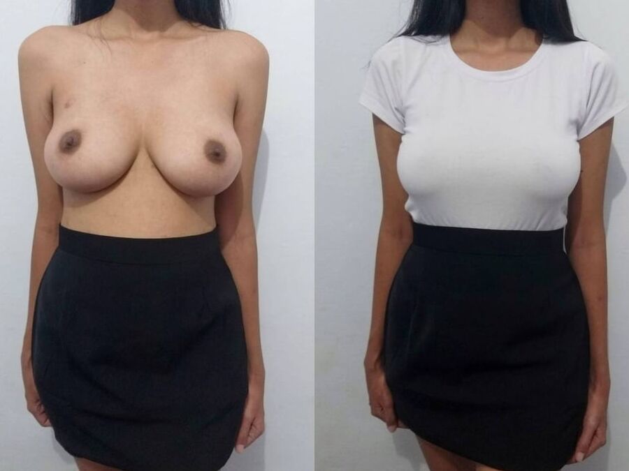 Dressed and undressed