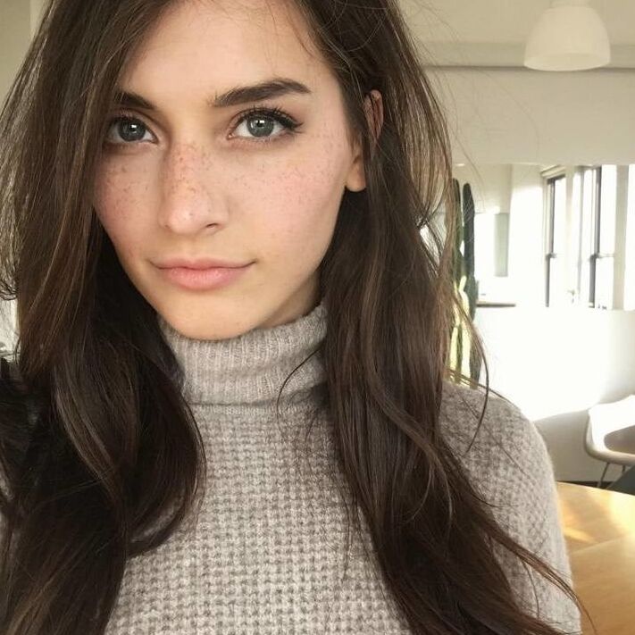 Freckles