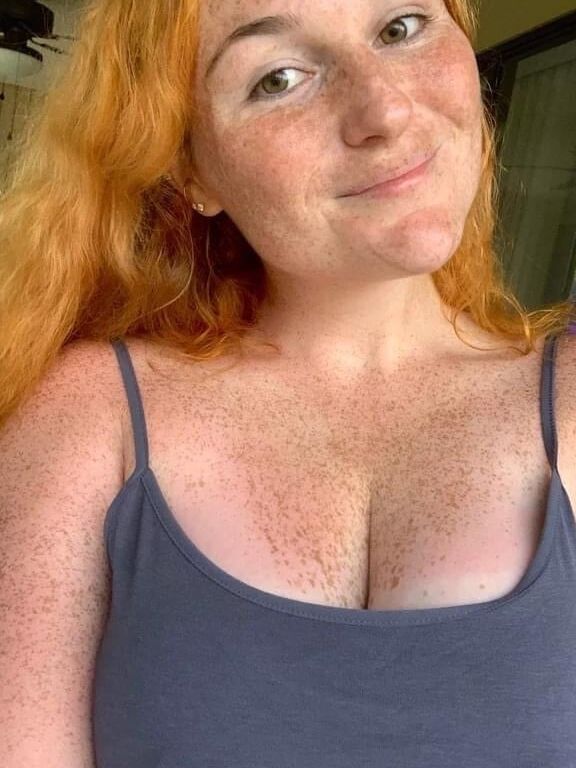 Redhair and freckles