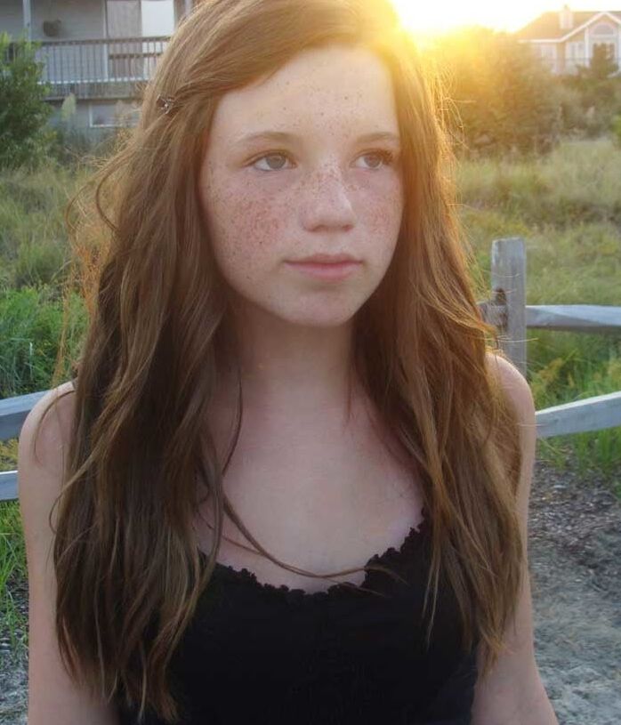Freckles