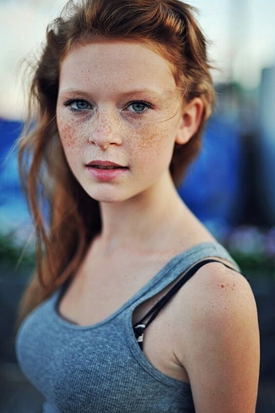 Freckles