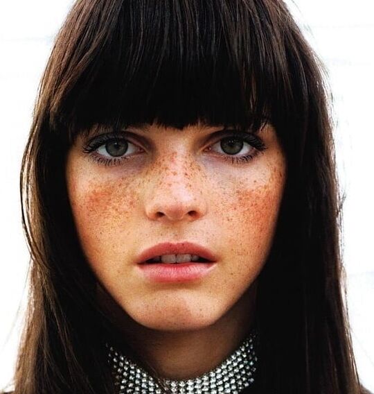 Freckles