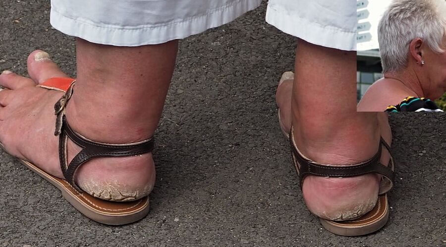 Amazing feet