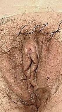minous poilus