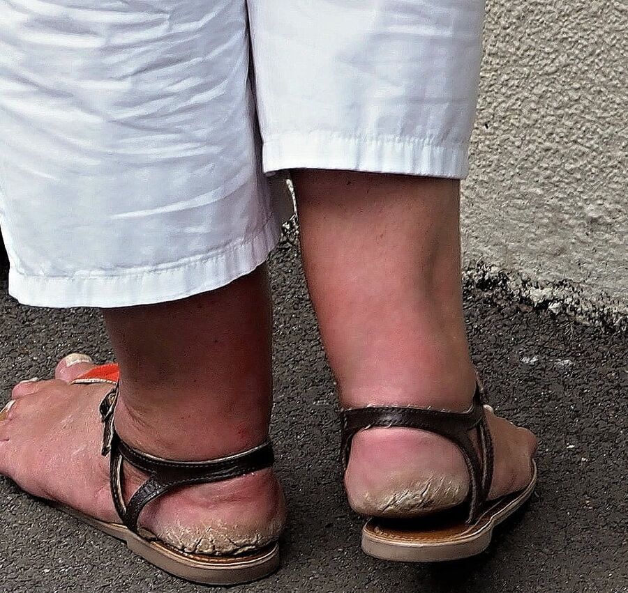 Amazing feet