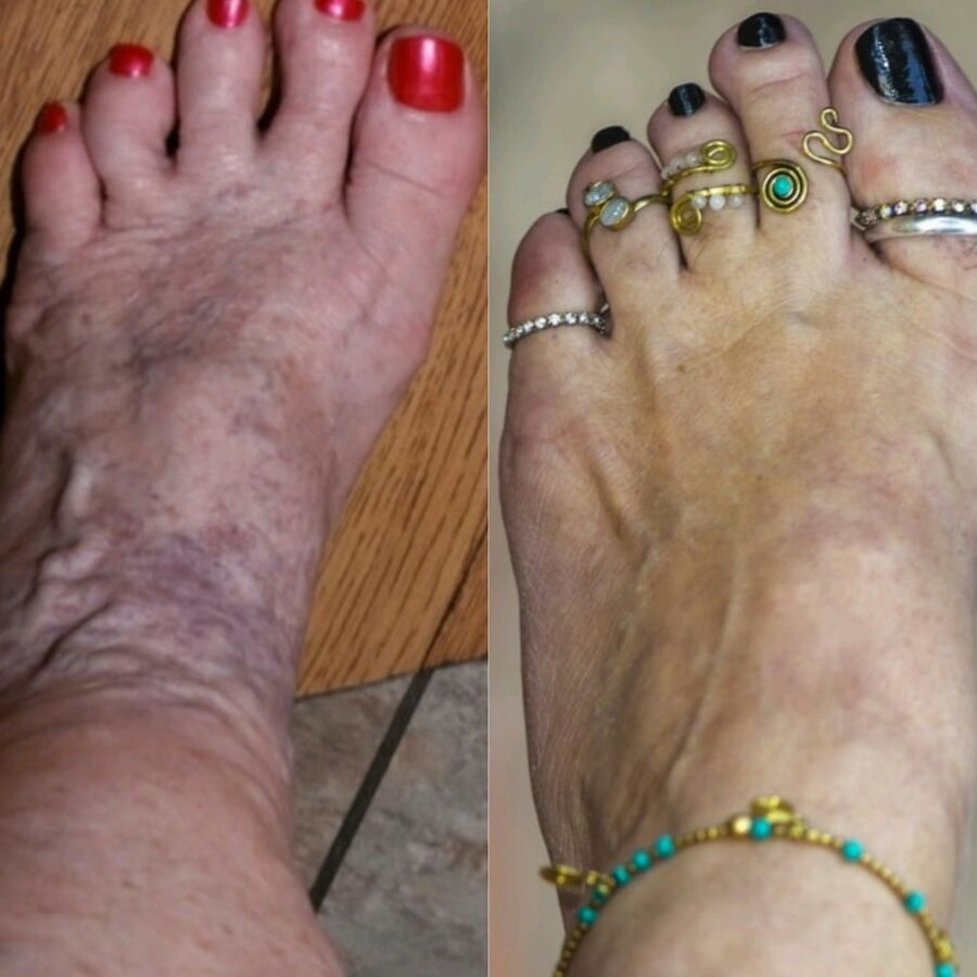 Amazing feet