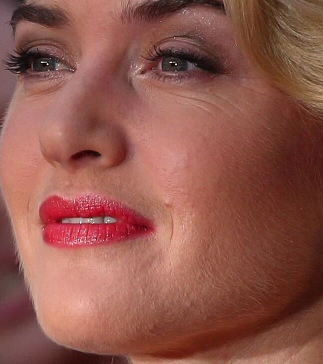 Female Facial Hair