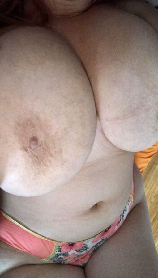 Tabby