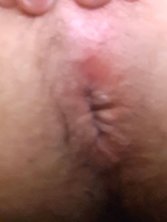 Strumpfhose anal
