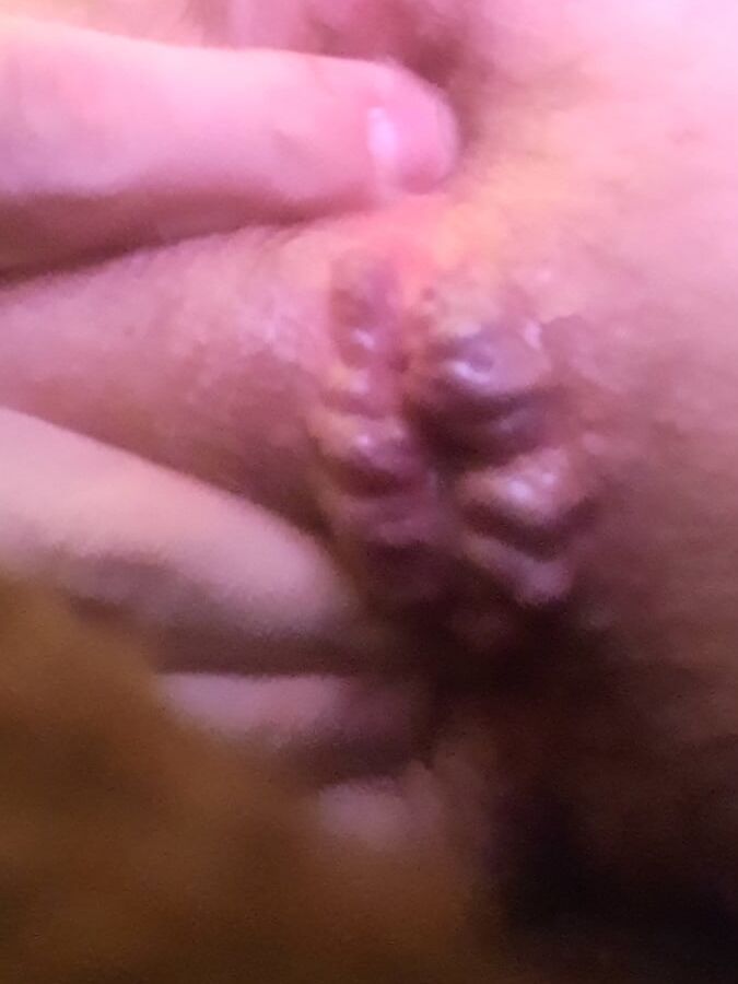 Strumpfhose anal