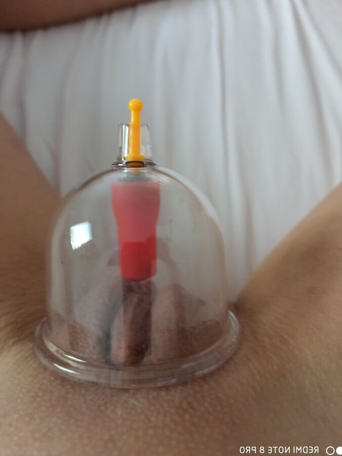 Cupping