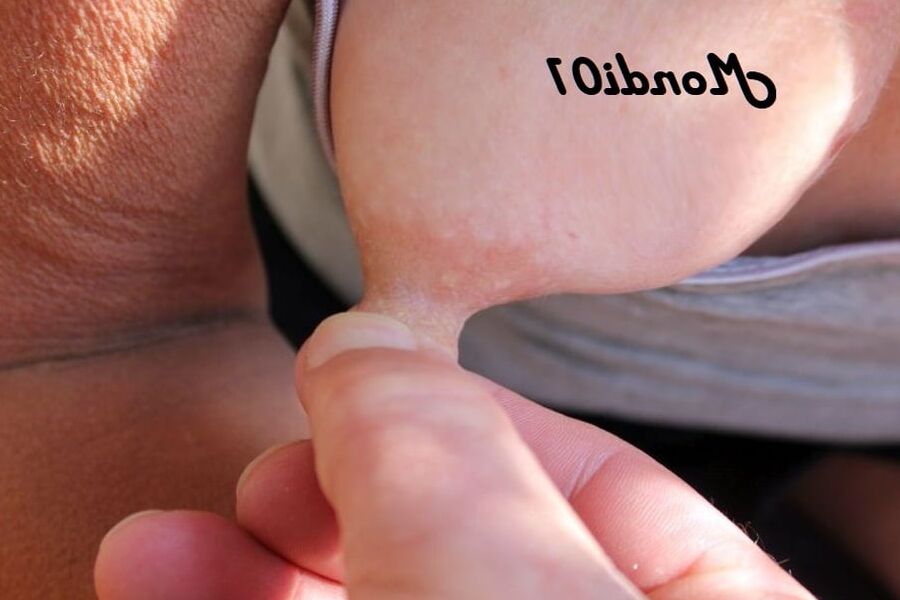 Nipple !