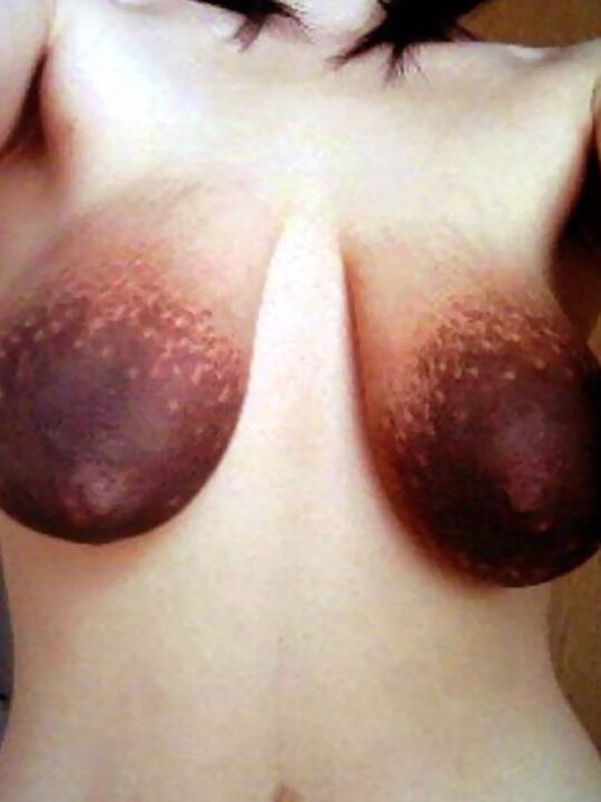 Suckable areolas