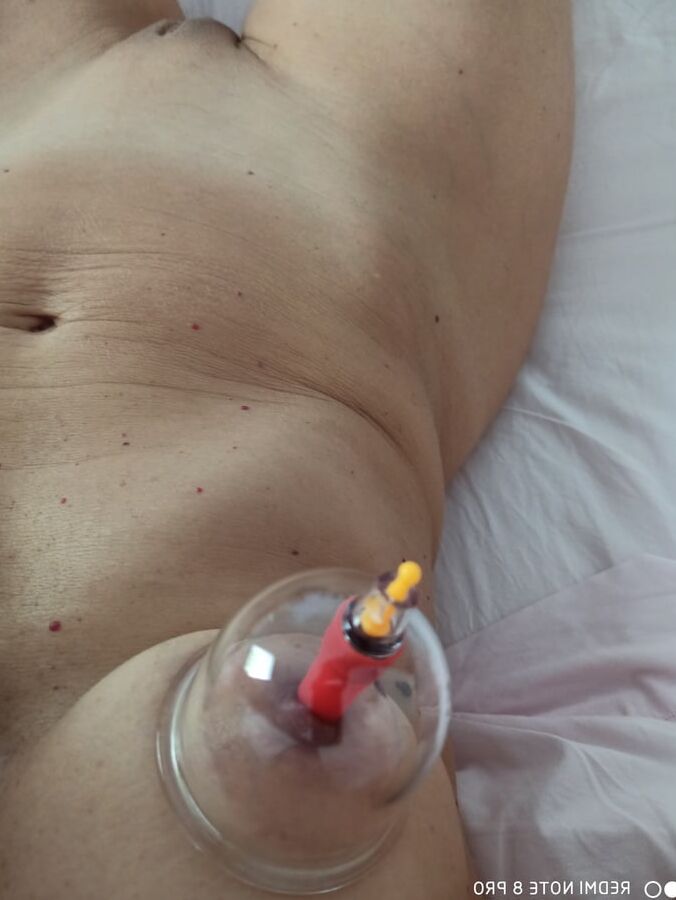 Cupping
