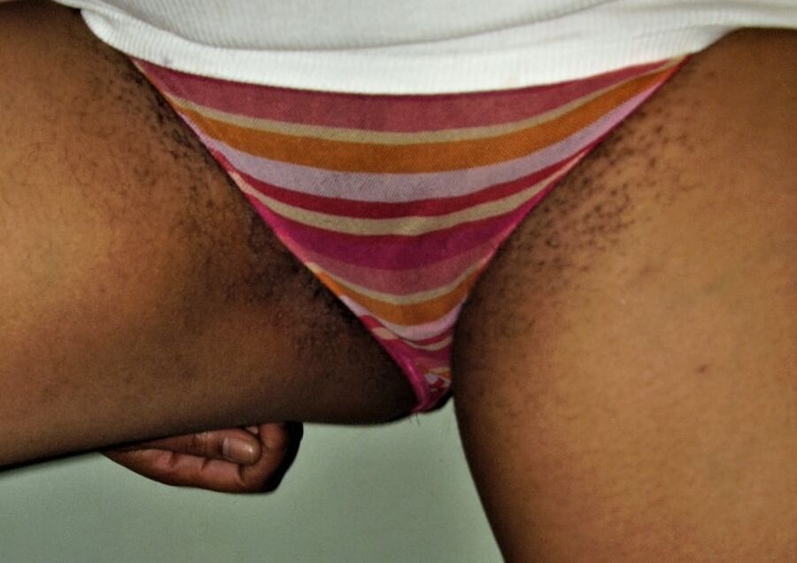 razor bumps Jamaican pussy