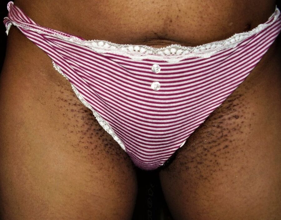 razor bumps Jamaican pussy