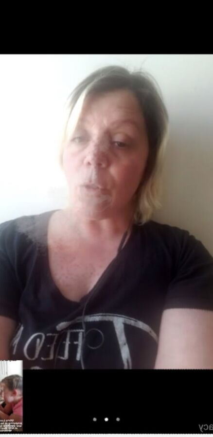 Vid Chat : Stoned FRECKLED &amp; Blacked