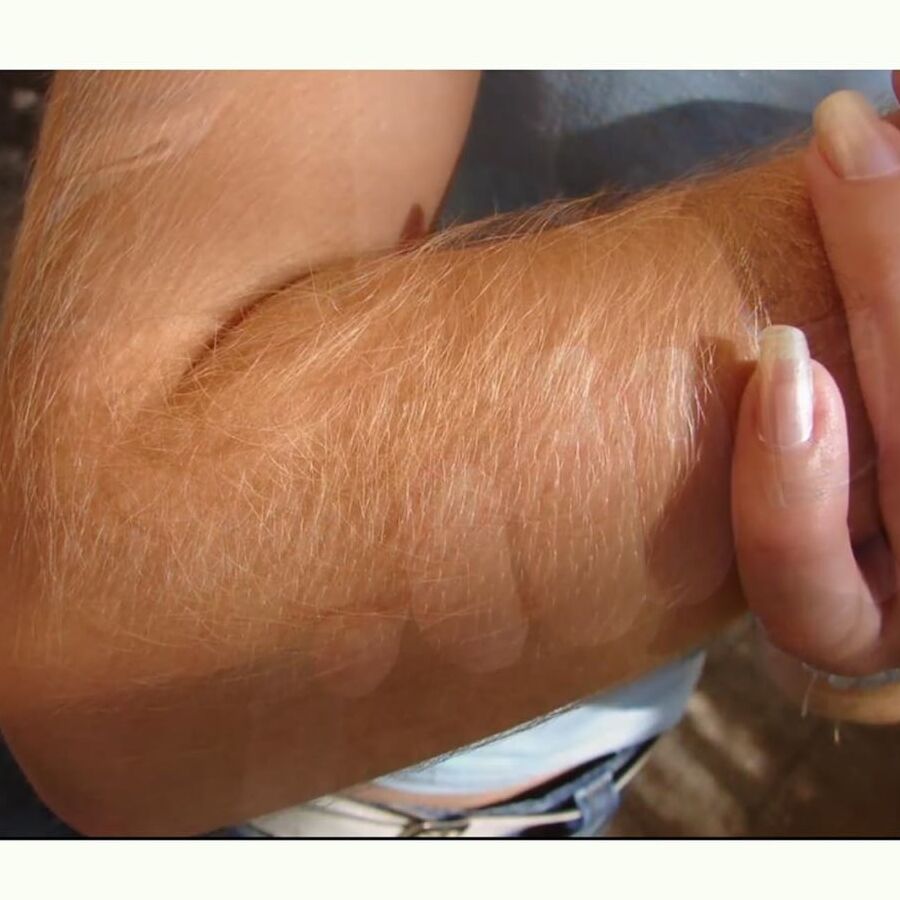 hairy arms collection