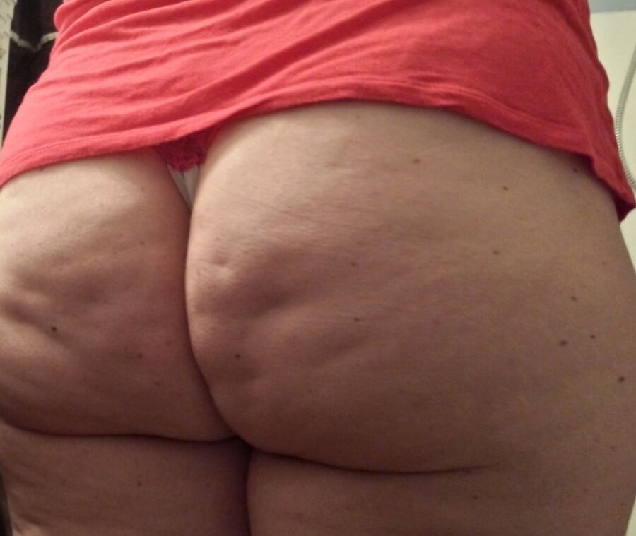 Cellulite Dimples