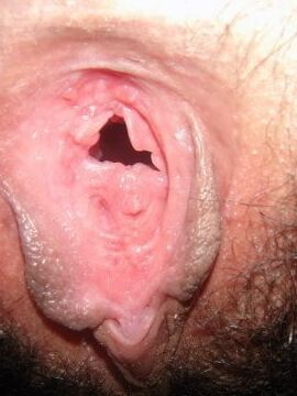 Pussy Lips