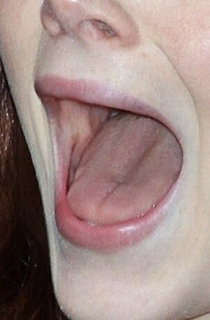 EMMA STONE