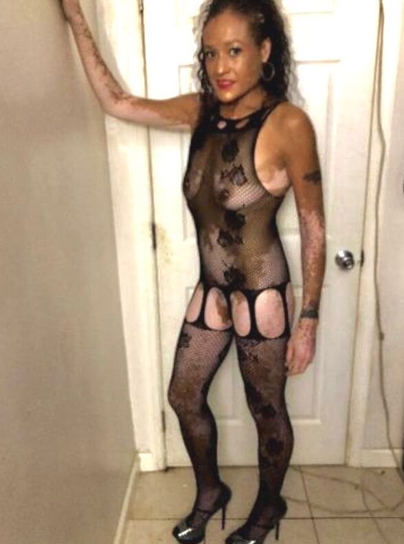 Local Whore - With Vitiligo