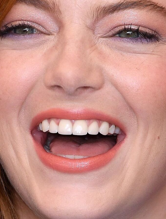 EMMA STONE