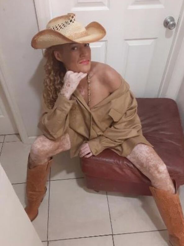 Local Whore - With Vitiligo