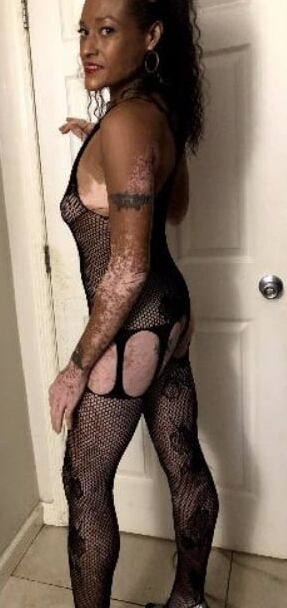 Local Whore - With Vitiligo
