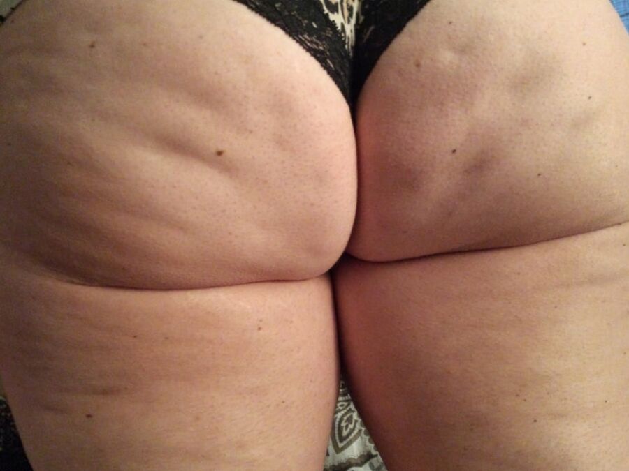 Cellulite Dimples