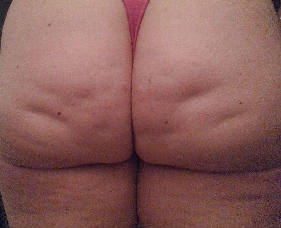 Cellulite Dimples