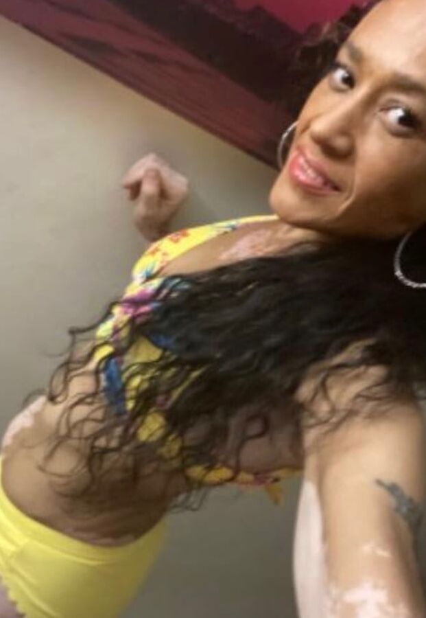 Local Whore - With Vitiligo
