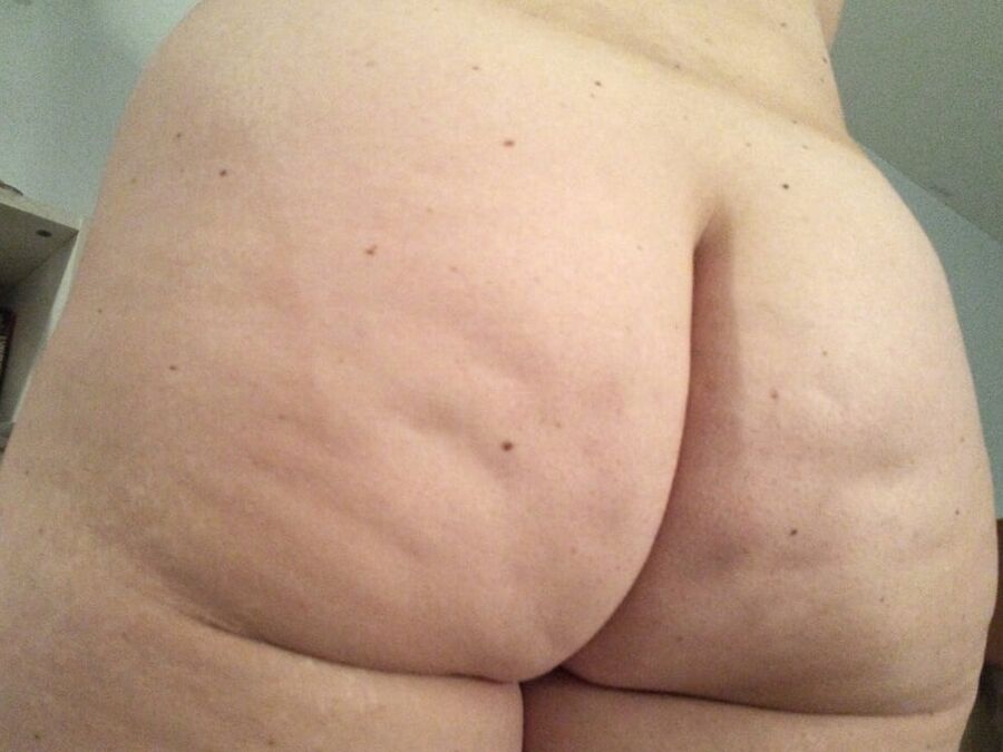 Cellulite Dimples