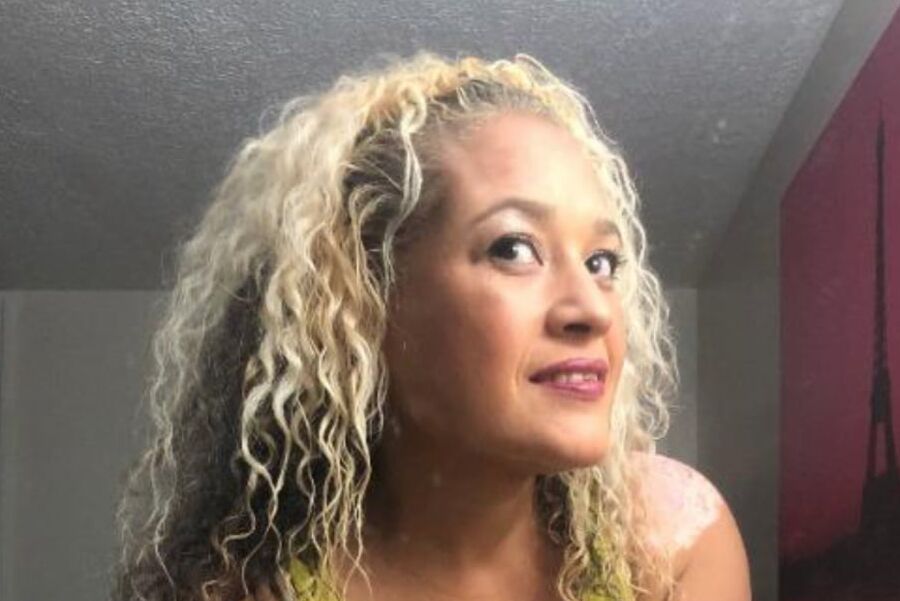 Local Whore - With Vitiligo