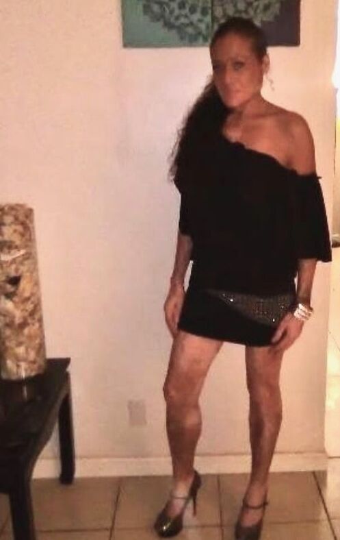 Local Whore - With Vitiligo
