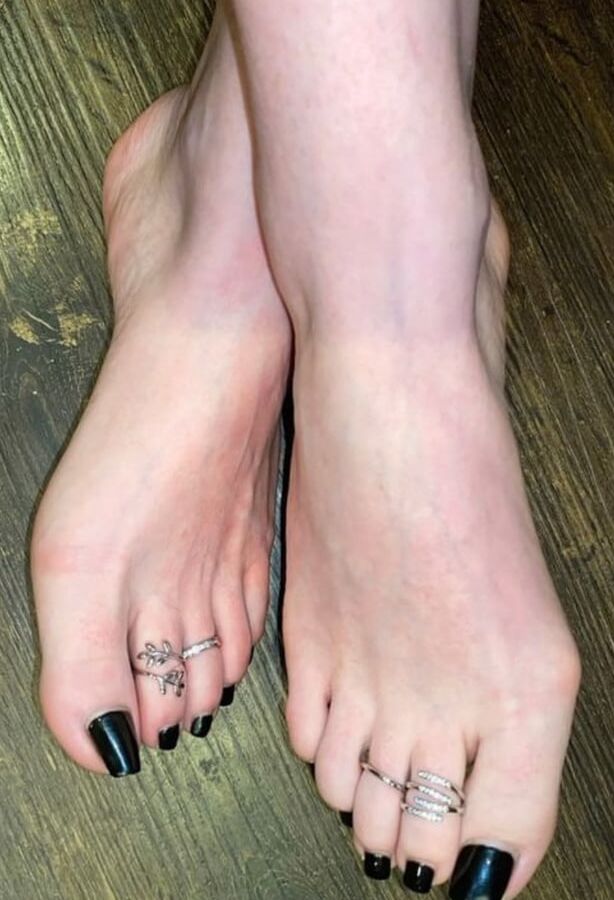 Beautiful bunions