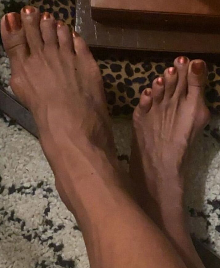 Beautiful bunions