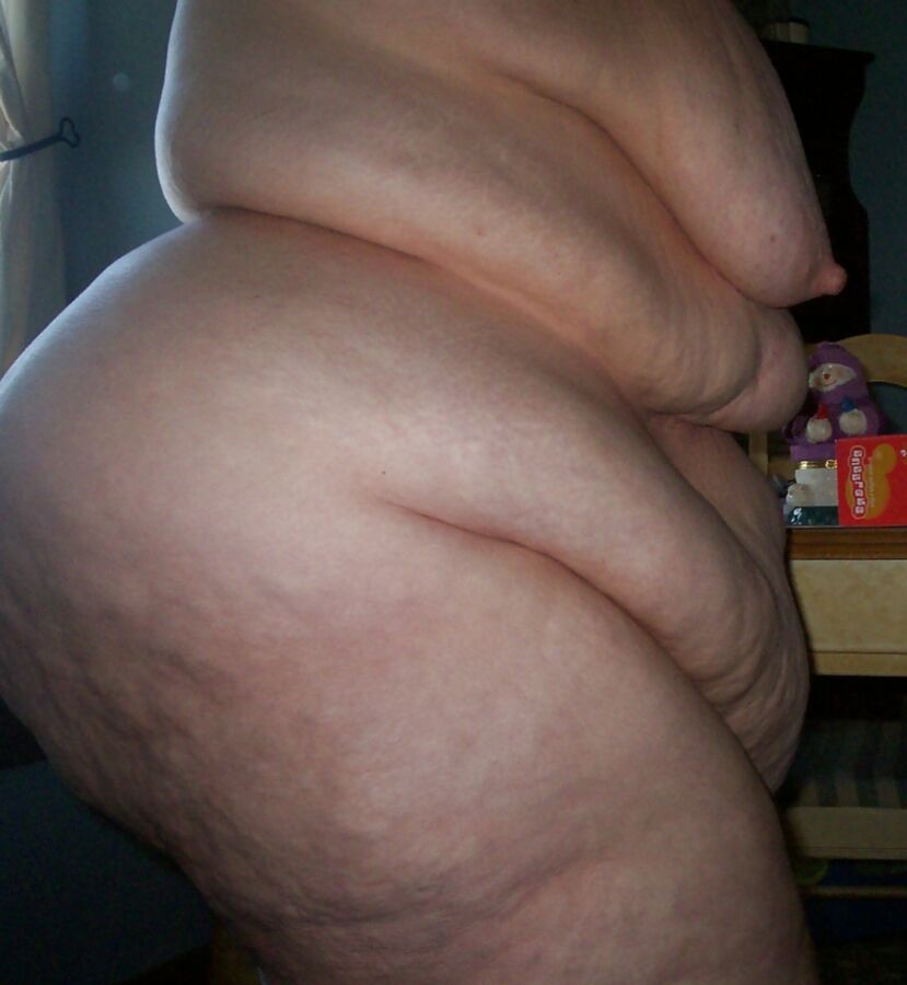 more photos legs