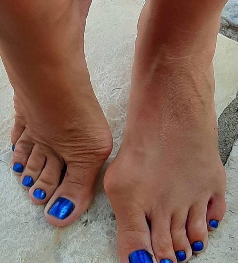 Beautiful bunions