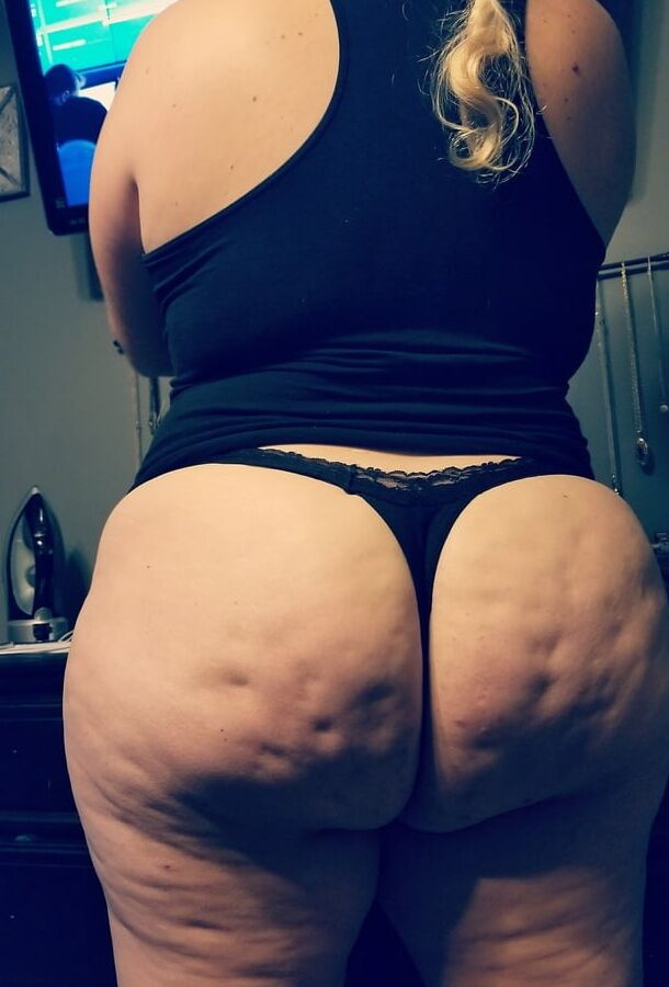 cellulite